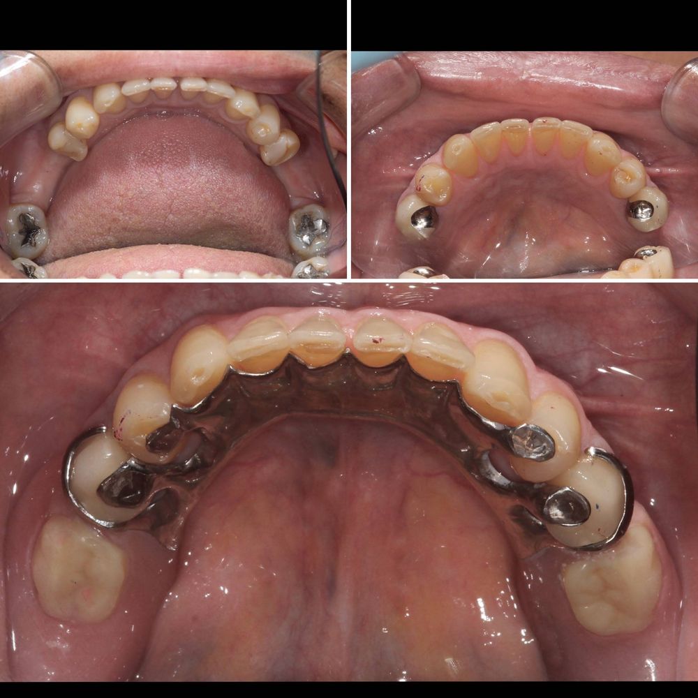 Mandibular View