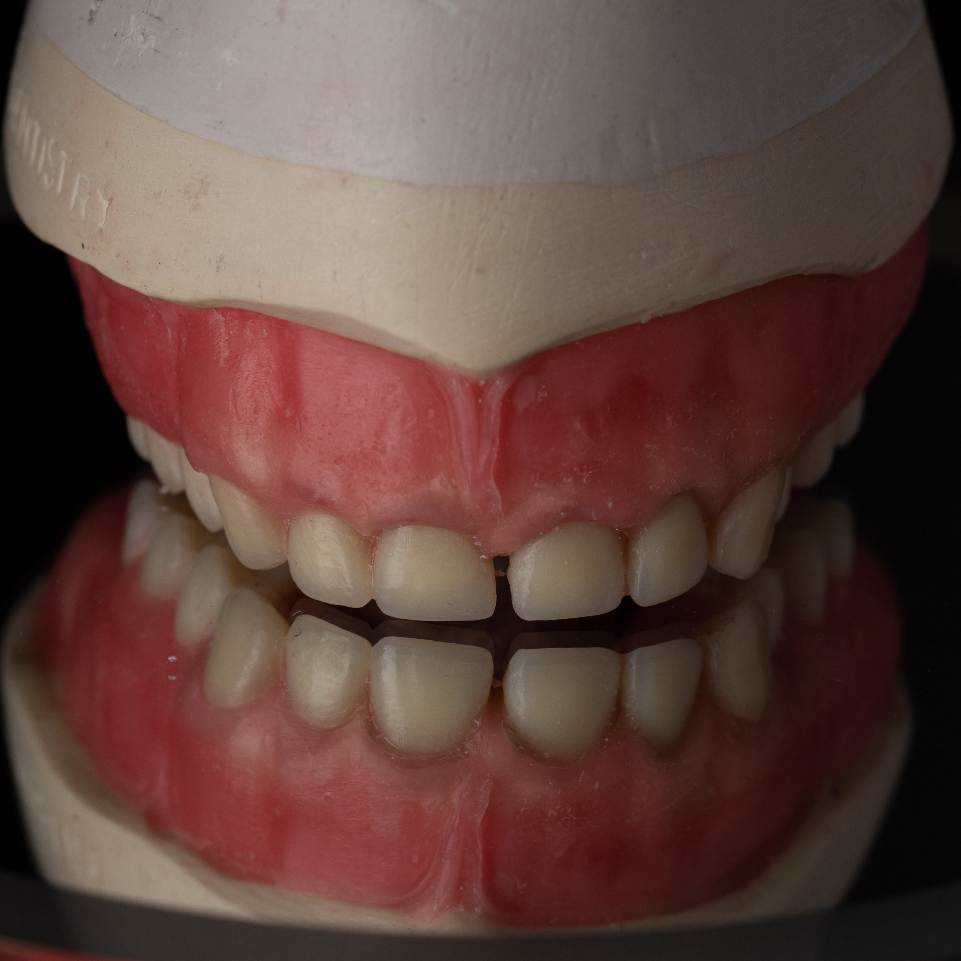 Complete Denture
