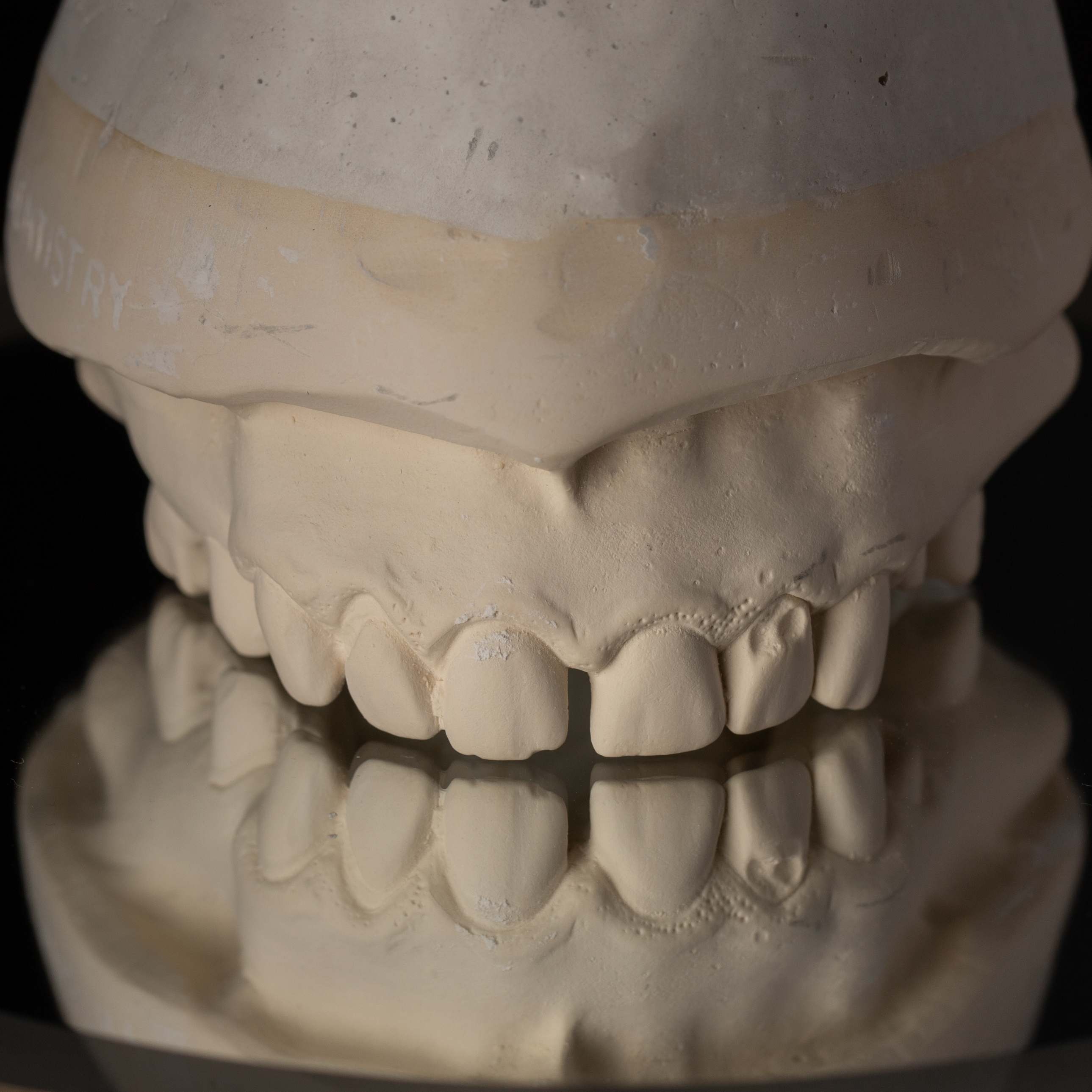 Cast Frontal View